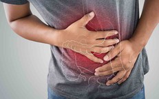 Dấu hiệu thường gặp của vi&#234;m lo&#233;t đại trực tr&#224;ng 