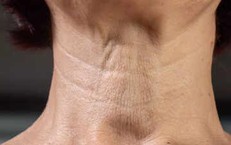 4 b&#224;i tập đơn giản x&#243;a nếp nhăn, l&#224;m săn chắc v&#249;ng cổ tự nhi&#234;n tại nh&#224;