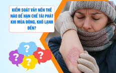 Kiểm so&#225;t vảy nến thế n&#224;o để hạn chế t&#225;i ph&#225;t v&#224;o m&#249;a đ&#244;ng kh&#244; lạnh?