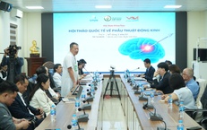 Kỹ thuật mổ mới gi&#250;p h&#224;ng trăm ngh&#236;n người bị động kinh kh&#225;ng thuốc n&#226;ng chất lượng sống