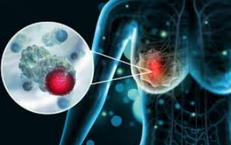 Nghiên cứu vaccine mới mở ra hy vọng chống lại ung thư vú thể nguy hiểm nhất