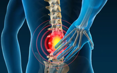 Tưởng đau lưng do thoái hóa cột sống, người đàn ông bất ngờ phát hiện bệnh máu ác tính 