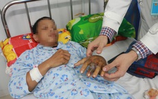 Bệnh viện tuyến tỉnh cứu sống nam thanh niên bị rắn cực độc cắn nguy kịch