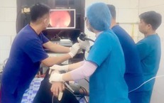 Suýt thủng thực quản vì viên thuốc 