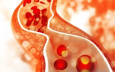 Tăng triglycerid máu: Hiểm họa tiềm ẩn và cách kiểm soát hiệu quả