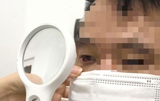 Người đàn ông bị rận mu hành hạ suốt một năm