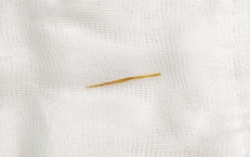 Thủng ruột do thói quen rất nhiều người mắc