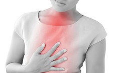 Ợ nóng, ợ chua  khi nào liên quan đến bệnh lý cần lo lắng?