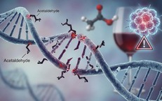 Rượu bia và ung thư vú: sự thật ít ai biết khiến phụ nữ trẻ lo ngại