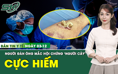 Bản tin Y tế 3/12: Người đ&#224;n &#244;ng mắc bệnh &#39;người c&#226;y’ được phẫu thuật tho&#225;t khỏi u gai sừng 