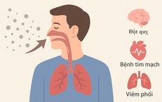 Bụi mịn &quot;đe doạ&quot; phổi v&#224; những người mắc bệnh mạn t&#237;nh như n&#224;o?
