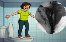 Bồn cầu bất ngờ vỡ khi đứng l&#234;n, b&#233; trai 8 tuổi bị r&#225;ch 25 cm lưng