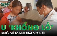 Cắt khối u vú to như trái dưa hấu cho bệnh nhân Campuchia