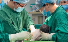 Sản phụ trẻ ở B&#236;nh Dương sinh 2 b&#233; trai sau ca gh&#233;p nối tay đặc biệt
