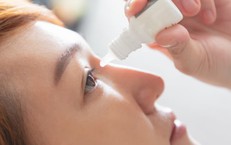 Kh&#244; mắt chữa thế n&#224;o?