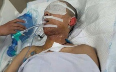 Sự sống mong manh của nam sinh lớp 12 bị s&#233;t đ&#225;nh nguy kịch khi đi phụ mẹ ngo&#224;i đồng