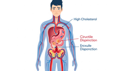Cholesterol cao c&#243; thể g&#226;y ra rối loạn cương dương?