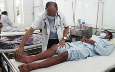 Sốt xuất huyết Dengue: Nguy kịch v&#236; chủ quan
