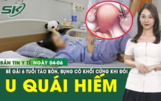 Bản tin Y tế 4/6: B&#233; g&#225;i 6 tuổi ph&#225;t hiện u qu&#225;i buồng trứng hiếm gặp từ dấu hiệu t&#225;o b&#243;n