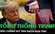 Nh&#224; Trắng l&#234;n tiếng về chứng suy tĩnh mạch của Tổng thống Trump