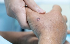 Chạm v&#224;o tổ ong v&#242; vẽ, người đ&#224;n &#244;ng sốc phản vệ su&#253;t mất mạng