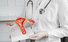 6 bệnh l&#253; c&#243; thể phải phẫu thuật cắt bỏ tử cung