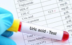Người bị tăng acid uric cần lưu &#253; g&#236; để ph&#242;ng ngừa gout hiệu quả?