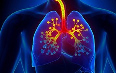 Những nguy&#234;n nh&#226;n g&#226;y phế quản co thắt 