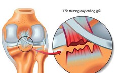 R&#225;ch d&#226;y chằng c&#243; liền lại kh&#244;ng?
