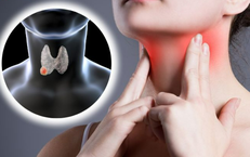 Chuyên gia chỉ cách ổn định nhân tuyến giáp: Không to lên, không biến chứng