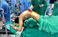 10 giờ phẫu thuật giải cứu người đàn ông 'cong như con tôm' , 7 năm cúi mặt xuống đất