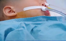 Sức khỏe 3 bệnh nhân ngộ độc hạt củ đậu ở Ninh Bình hiện ra sao?