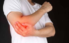 Cứng khớp khuỷu tay chữa cách nào?
