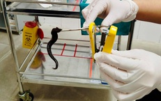 Đỉa dài 10 cm sống ký sinh trong mũi người bệnh