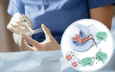 Khi nào nên làm xét nghiệm Pap để sàng lọc ung thư cổ tử cung?