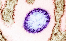 Những rào cản khiến virus Nipah chưa có vaccine