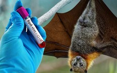 Virus Nipah gây bệnh gì, nguy hiểm như thế nào?