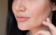 Ngứa ngáy da mặt, khó chịu, cảnh giác với nhiễm nấm