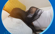 Thói quen khi ngủ gây rụng tóc và cách khắc phục