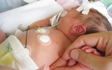 Trẻ mắc bệnh tim bẩm sinh có tím cần phát hiện và điều trị sớm