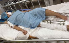 Cảnh khó khăn của cô gái dân tộc Mảng bị tai nạn giao thông cần sự trợ giúp của cộng đồng