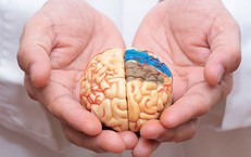 Nguyên nhân phổ biến gây đột quỵ và “thời gian vàng” trong cấp cứu