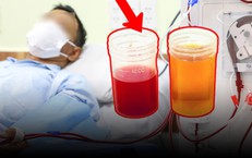 Tiểu ra máu đỏ như Coca, cụ ông tưởng viêm đường tiểu ai ngờ mắc ung thư