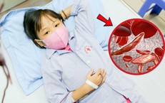 Giải mã nguyên nhân bố mẹ khỏe mạnh sinh con mắc bệnh tan máu bẩm sinh