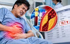Đau bụng dữ dội, nhập viện phát hiện chỉ số mỡ máu cao gấp gần 20 lần