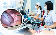 Bé gái 7 tuổi đau bụng dữ dội, bác sĩ phát hiện túi mật hoại tử