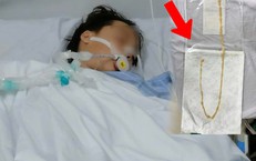 Người phụ nữ 48 tuổi phát hiện sán dây bò dài 70cm dù không có triệu chứng