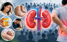 Hơn 10 triệu người Việt mắc bệnh thận: Dấu hiệu thường gặp dễ bị bỏ qua