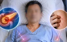 Tưởng dị ứng, người đàn ông 52 tuổi tử vong sau 6 tháng phát hiện ung thư