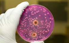 Cách phòng ngừa và đối phó với nấm Candida